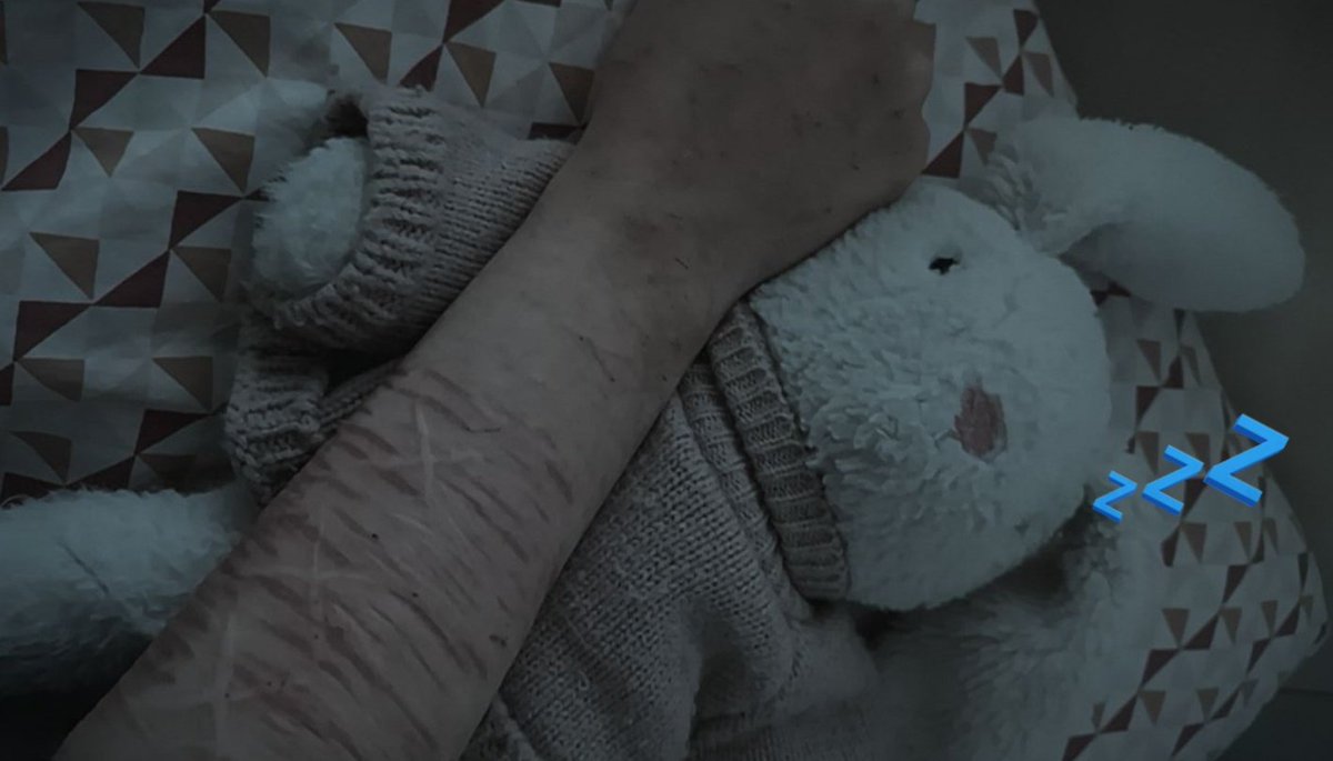 _Enachan376's tweet image. Itchy