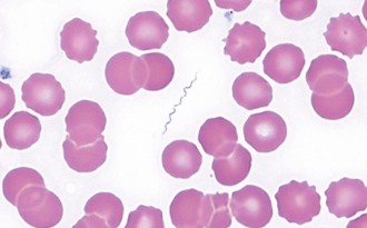 MicroBytes tweet media