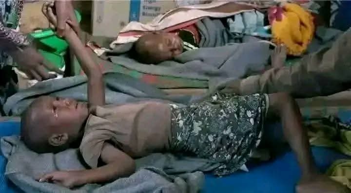 Awot1019's tweet photo. ን5ዓመት አብ ፍቆዶ ኬንዳ ዝተደርበየ ኣላሺ ዘይብሉ  ህዝቢ ምዕራብ ትግራይ #ሕፃፅ😳💔
@Tmhtvnews @OmnaTigray @DrTedros @hrw @UN @UNICEF
@WHOWPRO https://t.co/G0tQf4hhKR