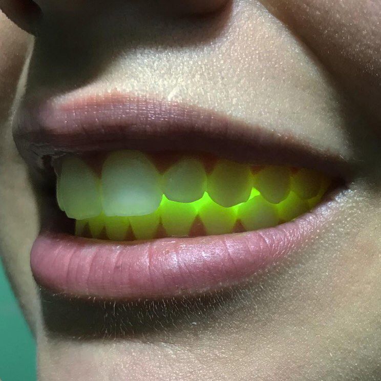 DOESNOTEX_IST's tweet image. 