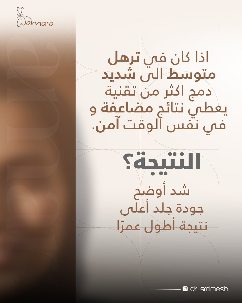 تتوقعوا ايش راح تكون النتيجة إذا دمجنا محفزات الكولاجين مع الأجهزة الحرارية 🤔

📍 حي الحمراء - طريق الملك عبدالله
الرياض، المملكة العربية السعودية

📩 للتواصل:
☎️ 920021331
📞 0509334646
📞 0509334747
 
#محفزات_الكولاجين #بشرة_صحية #نضارة_دائمة #dr_smimesh