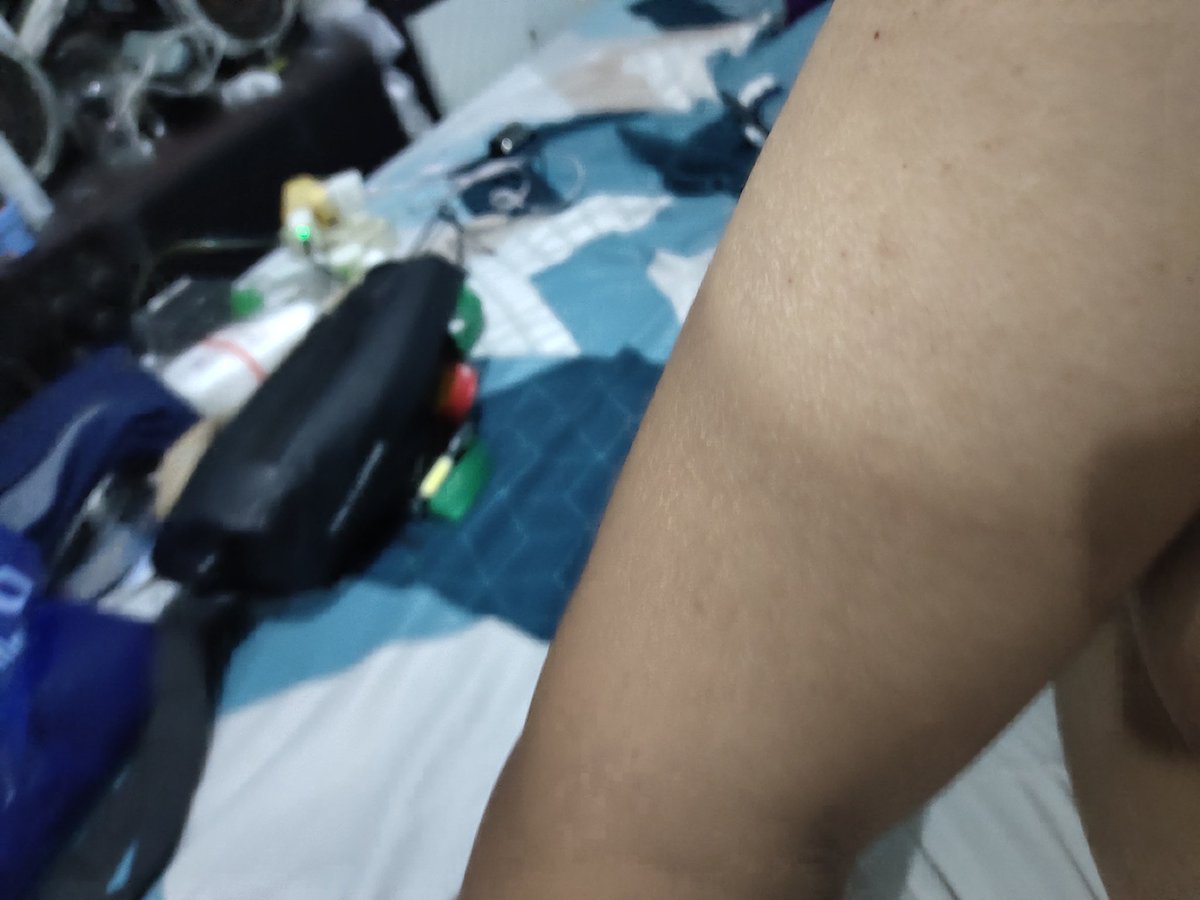 samudrog's tweet image. Hasil macull seharian