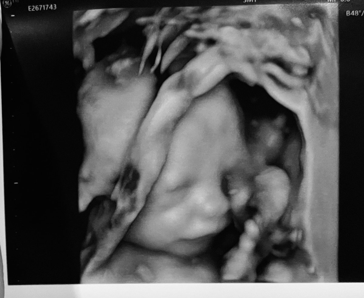 An🕳na tweet media