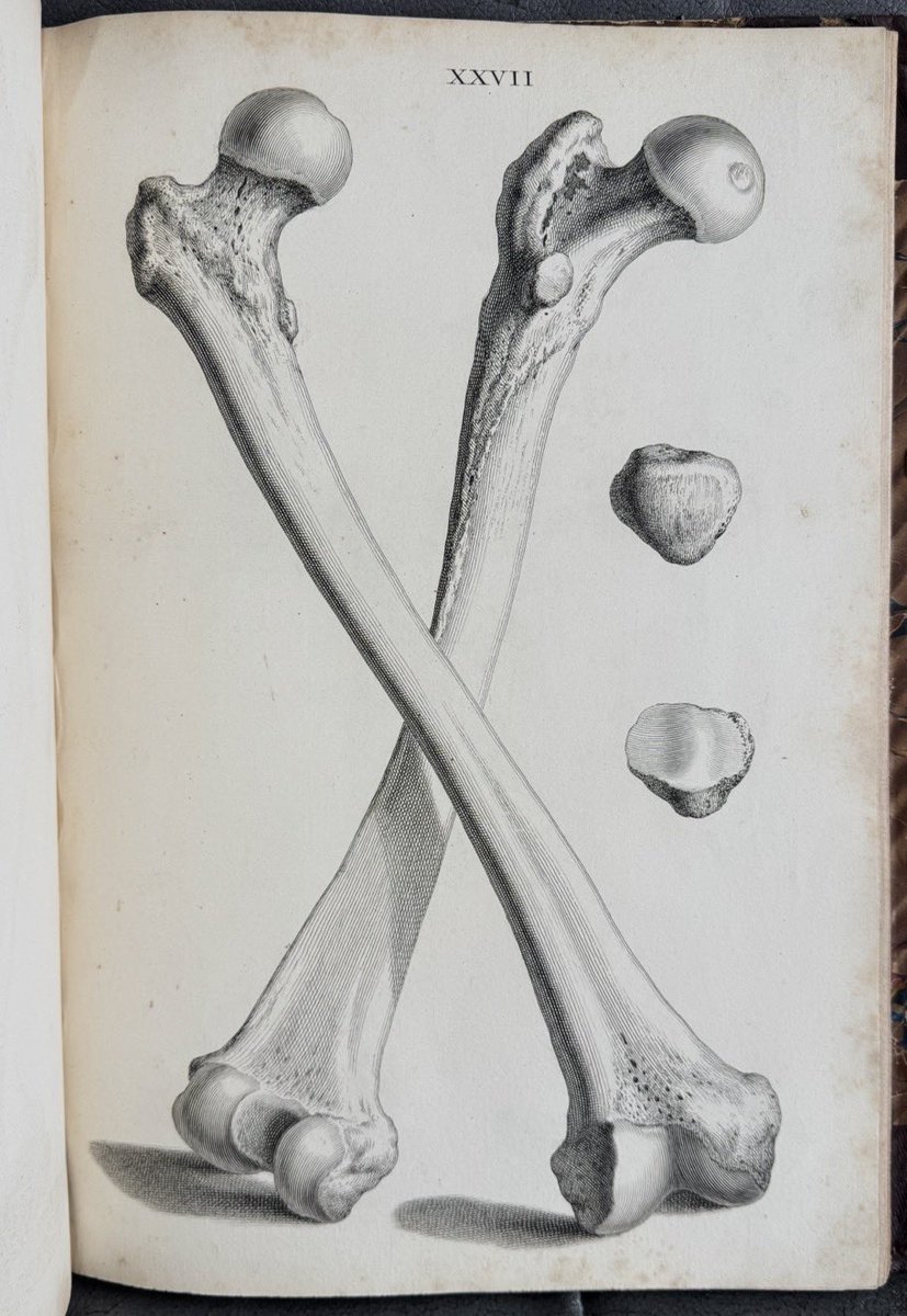Cowper/Bidloo on the left. Cheselden on the right.