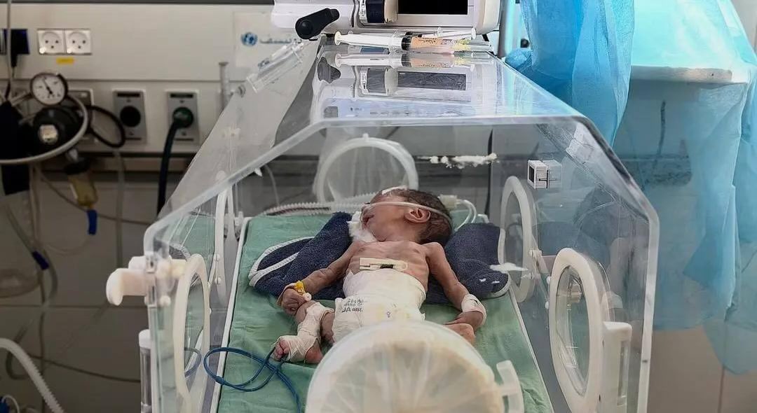 The 17-day-old infant, Hassan Wahdan, passed away due to a severe heart condition that required urgent surgical intervention.

But because of the Israeli siege that prevents the entry of aid, Hassan lost his life.