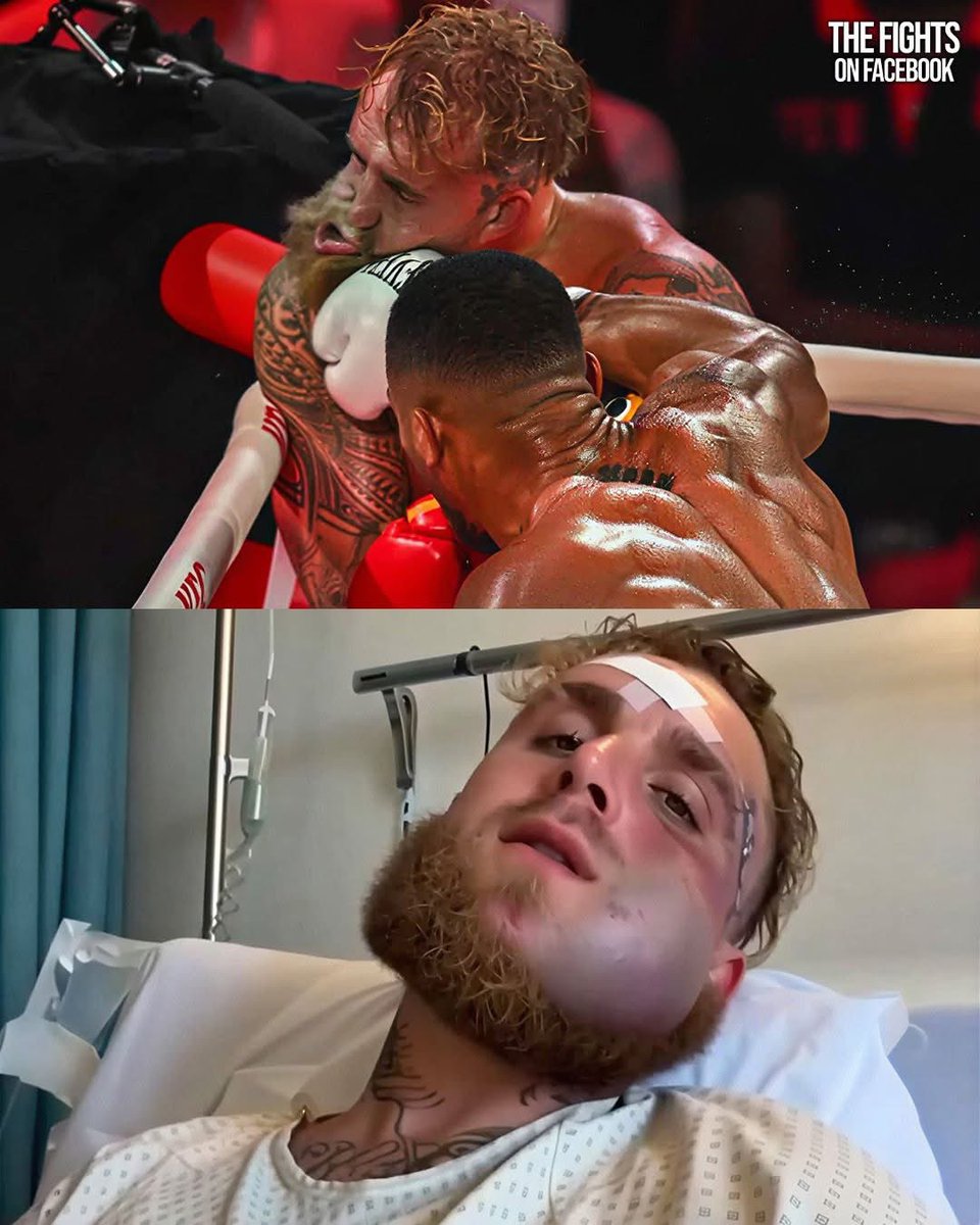 Bornakang's tweet image. Jake Paul's jaw after Anthony Joshua punch