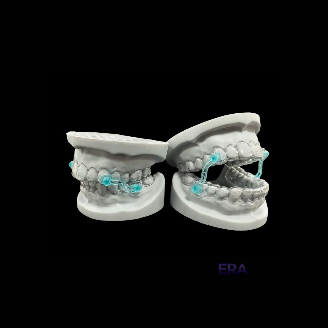 EraDentalLab's tweet image. Snoring Guard #DentalLab #DentalLabTech #DentalProsthetics #DentalRestoration #SnoringGuard #DentalImplants #Dentistry 

©ERA Dental Lab. All Rights Reserved.
Unauthorized use or reproduction of our work is strictly prohibited. Do not copy or repost without permission.