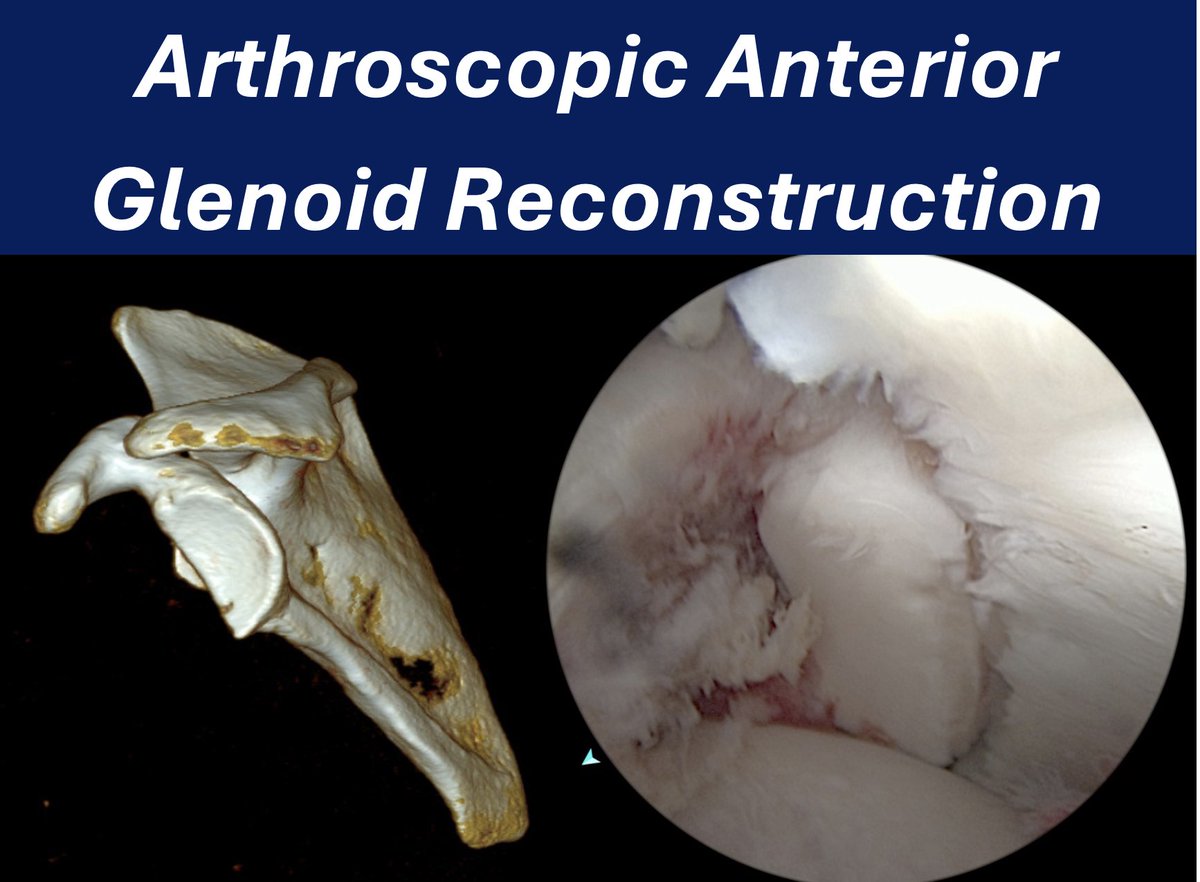 Erick Marigi, MD tweet media