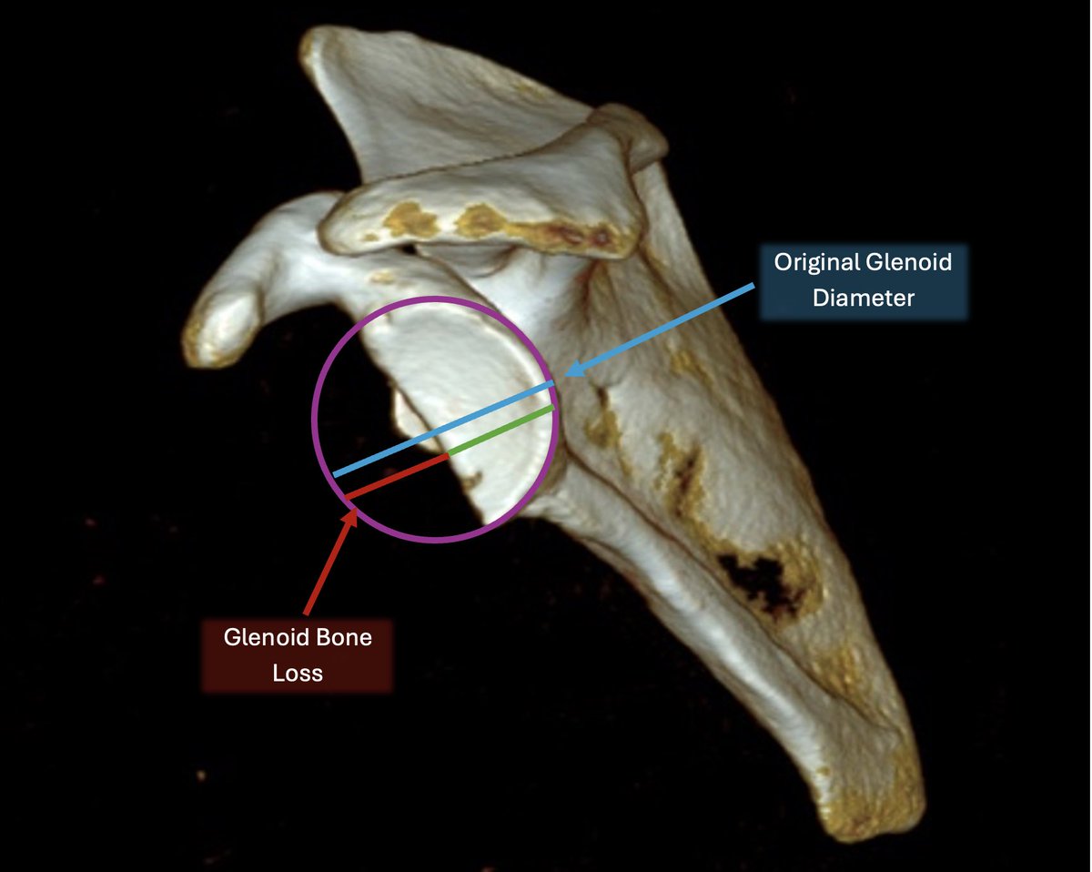 Erick Marigi, MD tweet media