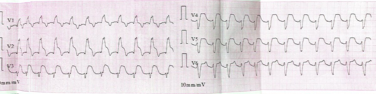 Miguel Hominal tweet media