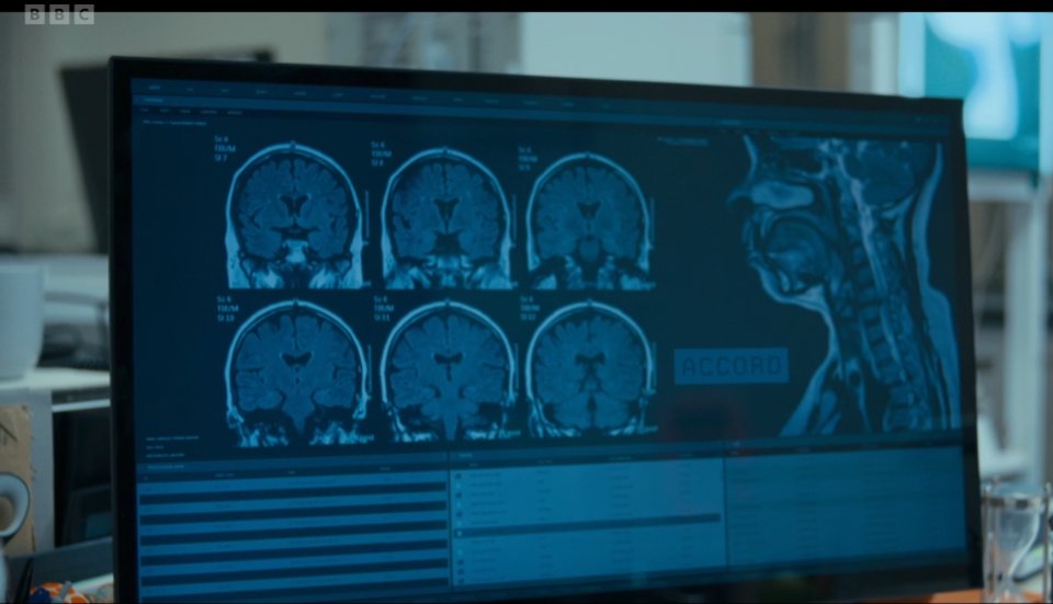 TardisTakes's tweet photo. Ok so if I'm getting this right, Barclay is turning into a fish because of the "Accord" which somehow appears to have changed his brain chemistry, as well as his physical biology? 

What? #TheWarBetween https://t.co/fDV0a329ez