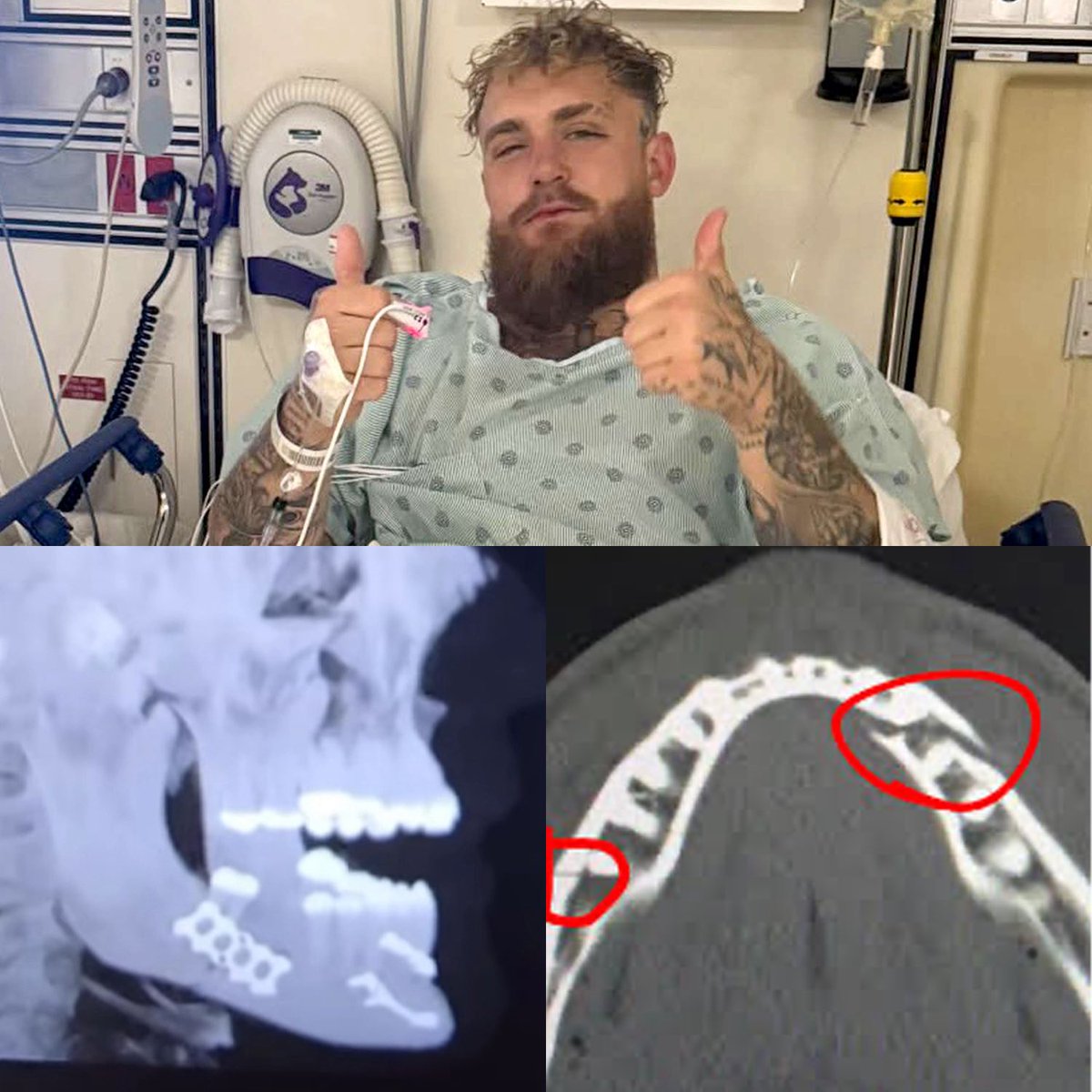 NFLMemes's tweet image. Me if an NFL player worth millions punched me in the face during a game