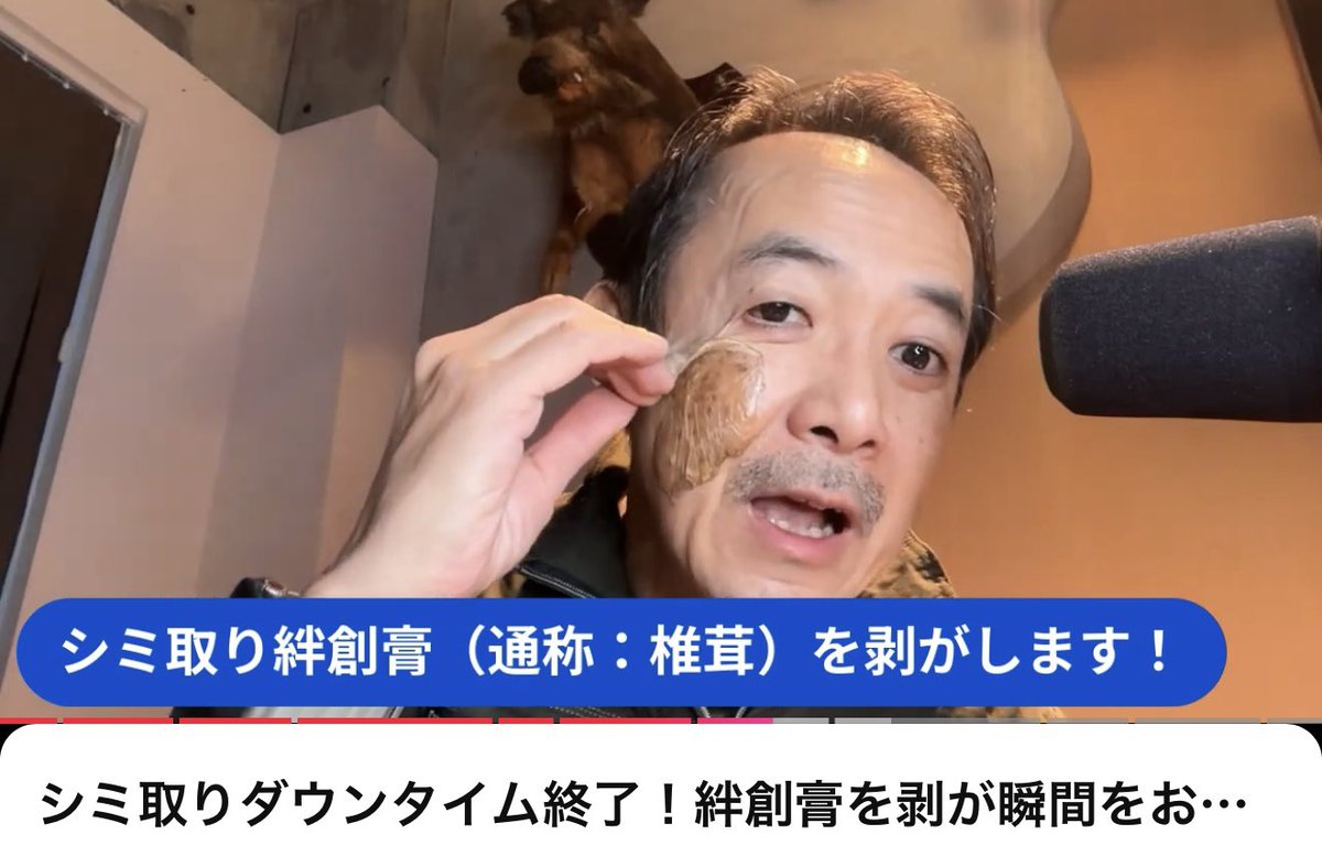 スキンケア界隈7】21日間のダウンタイムを経てついにシミ取り絆創膏を