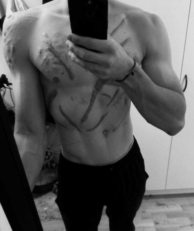 haru ！　（╹◡╹）♡ tweet media