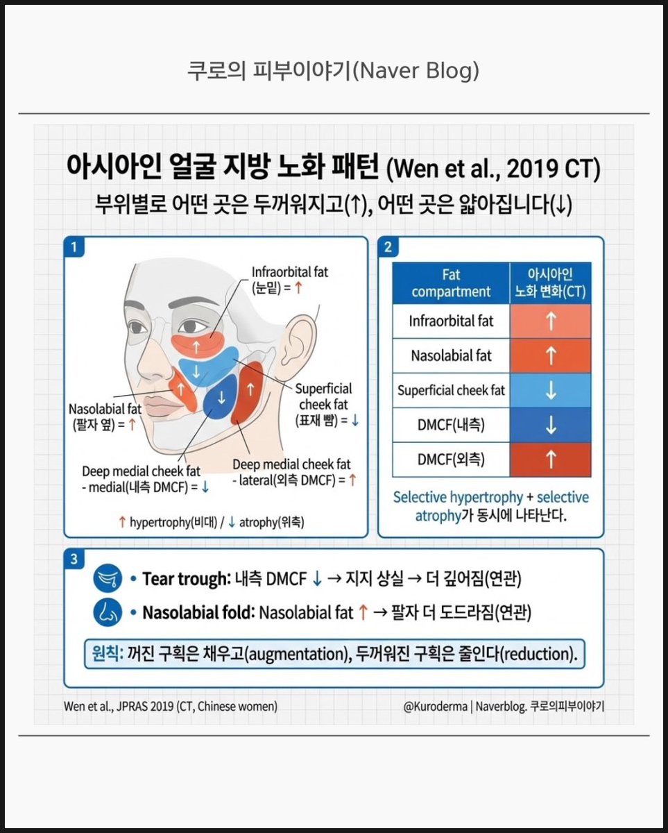 브이와이][VCMPRCY3]원형후크 양면세트 대용량 벌크 블랙 10mm, image size:963x1200