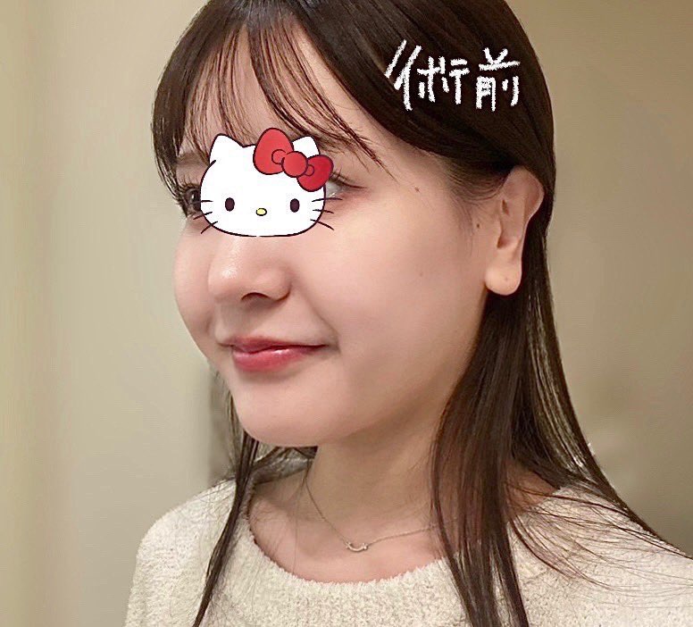 アゴになります mqdefault.jpg