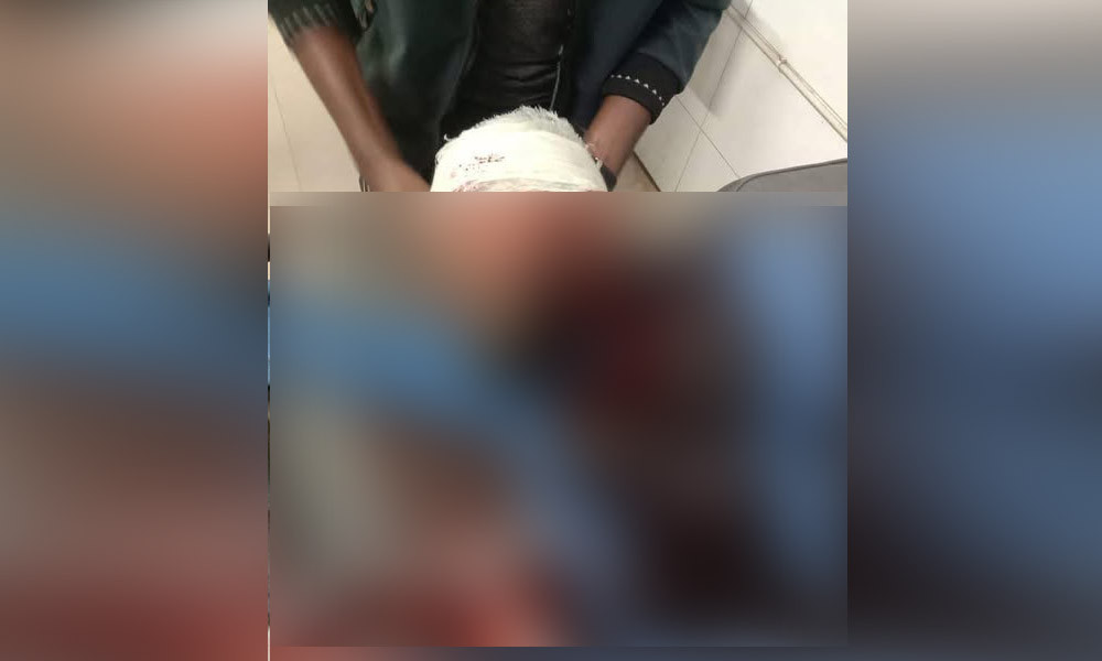 এবার এনসিপির খুলনা বিভাগীয় প্রধানের মাথায় গুলি