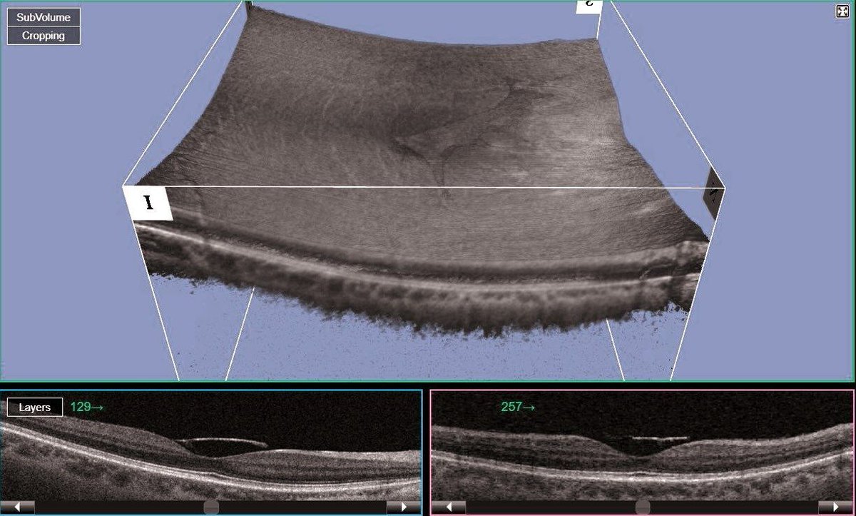 Eye Journal tweet media