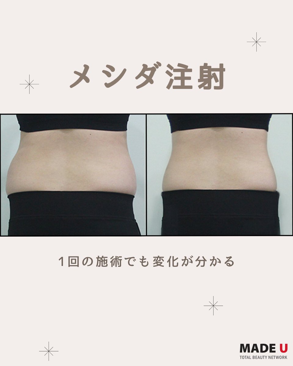 メイドユー医院 (@madeujp) / Posts / X
