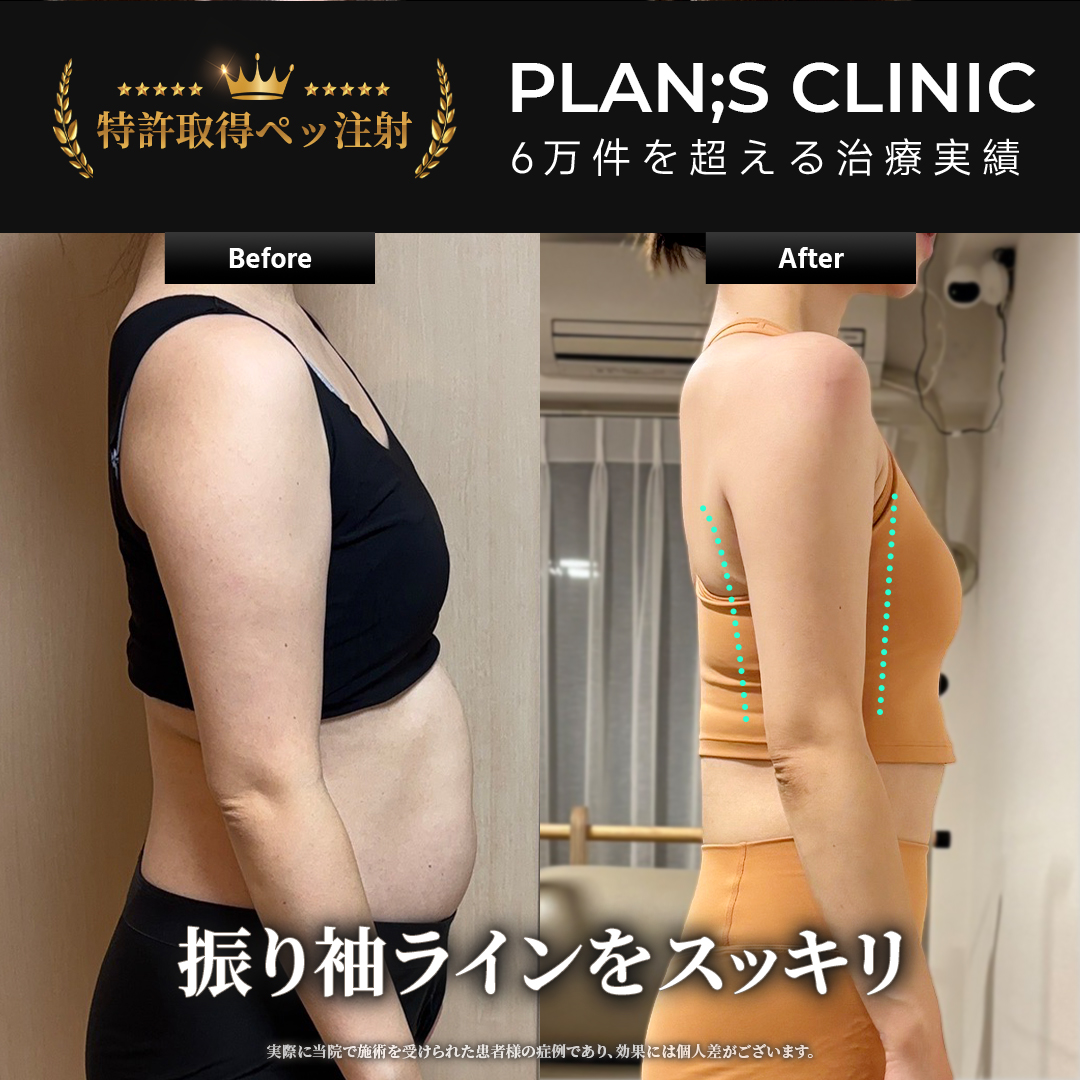 公式】プランエスクリニック（PLAN;SCLINIC） (@plansjp) / Posts / X