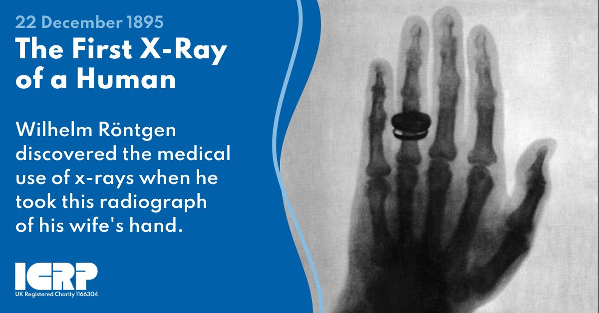ICRP's tweet image. December 22, 1895, marks the first documented human x-ray. After discovering the medical use of x-rays, Wilhelm Röntgen took this radiograph of his wife's hand.