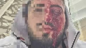 Siyonist İsrail Karşıtlığı Dünyada Yayılıyor

İşgalci İsrail medyası, Kıbrıs’ın Limassol kentinde bir İsrailli, kaldığı otelin yakınında telefonla İbranice konuştuğunu duyan Filistin destekçisi bir grup tarafından bayılana kadar dövüldü.