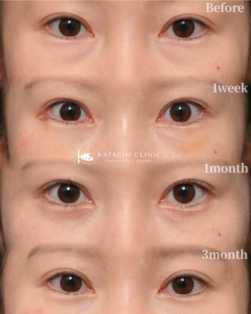 中村まさる🧑‍🎨絵を描く美容＆形成外科医 (@MI_PRAS_Masaru) / Posts / X