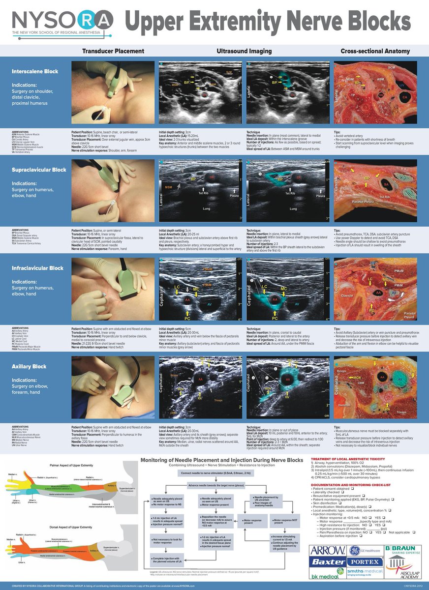drsthanus's tweet image. Upper extremity nerve blocks...

img.grepmed.com/uploads/3087/i…