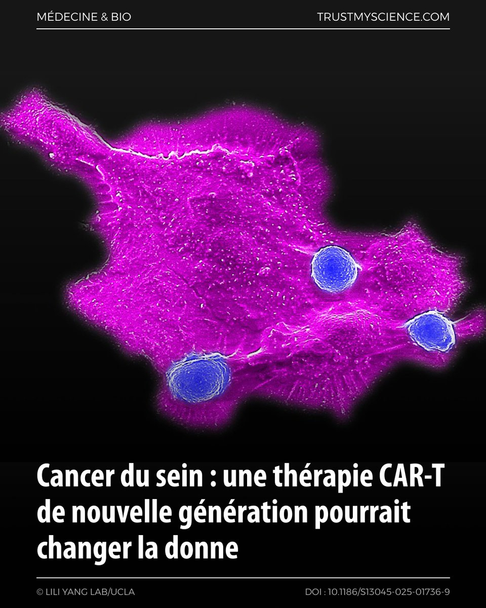 TrustMyScience's tweet image. TNBC : des CAR-NKT dérivées de sang de cordon et ciblant la mésothéline montrent une forte activité antitumorale en préclinique, avec effets via CAR + mécanismes NK et un profil de sécurité favorable rapporté.

trustmyscience.com/cancer-sein-th…
