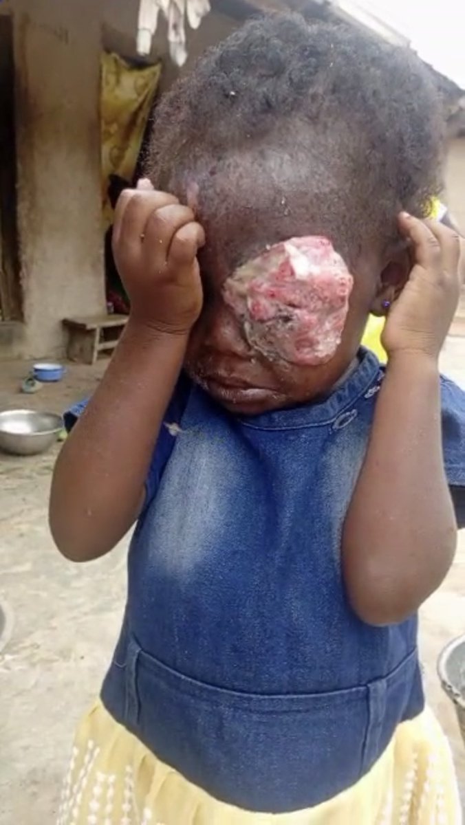 Akua’s Situation has become critical and needs an urgent attention. I have asked for her to be taken to the hospital while we also contribute to Support them. We have now raised GHc1,670 out of the GHc80,000. No Amount is too small. 
𝗗𝗶𝗮𝗹 *713*034# OR

𝐃𝐨𝐧𝐚𝐭𝐞 𝐯𝐢𝐚