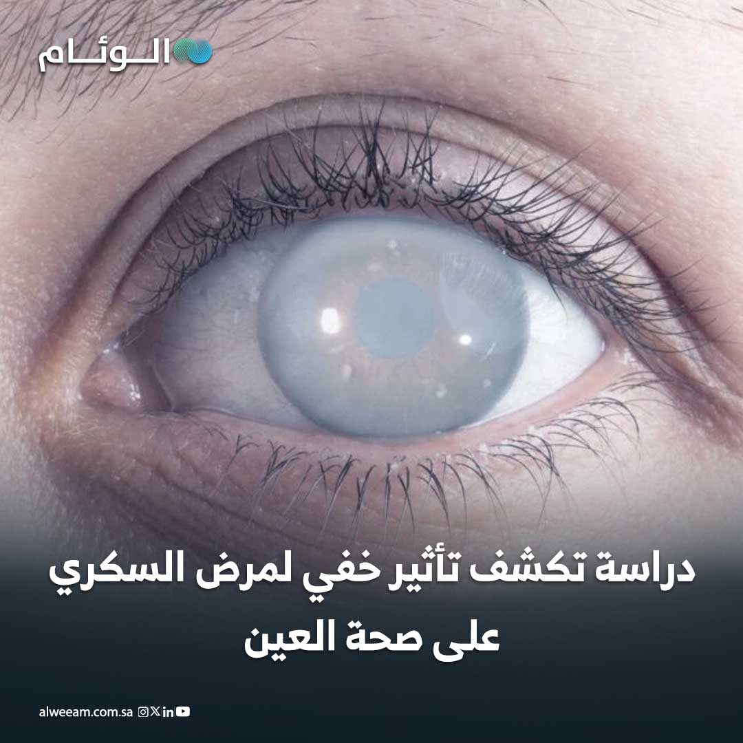 السكري يغير أنسجة الشبكية خلال أول 12 أسبوعاً فقط من الإصابة. الضرر يبدأ مجهرياً قبل ظهور الأعراض أو رصده بالفحوصات التقليدية. العين تعمل كأداة لرصد اضطرابات الجسم قبل تدهور البصر. الاكتشاف يساعد في حماية المرضى من فقدان النظر قبل فوات الأوان 