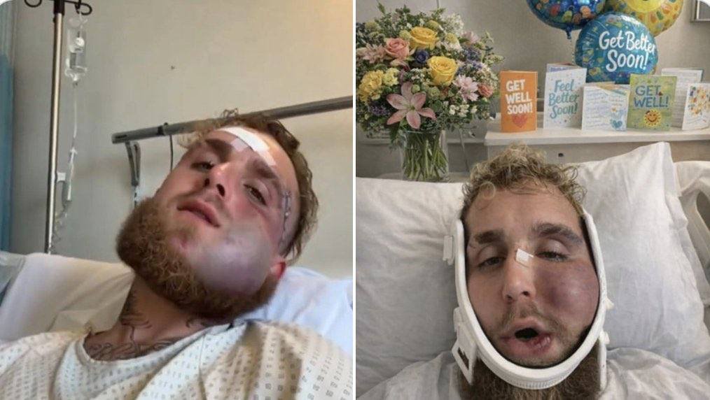 dubzyxbt's tweet image. Memecoin holders in 2025 🤕