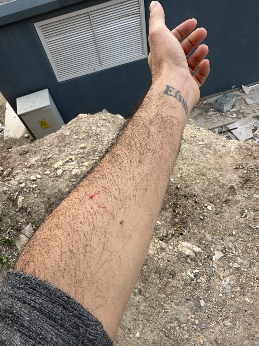 Ölmedim orospucocuklari