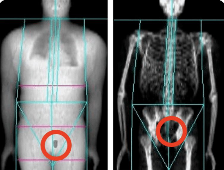 Still can't believe that they caught Do Kwon (founder of terra luna) with a Trezor carrying 10000 Bitcoin on it, stuck up in his rectum

That bear market was so crazy. Cant wait to see what the next bear market will bring