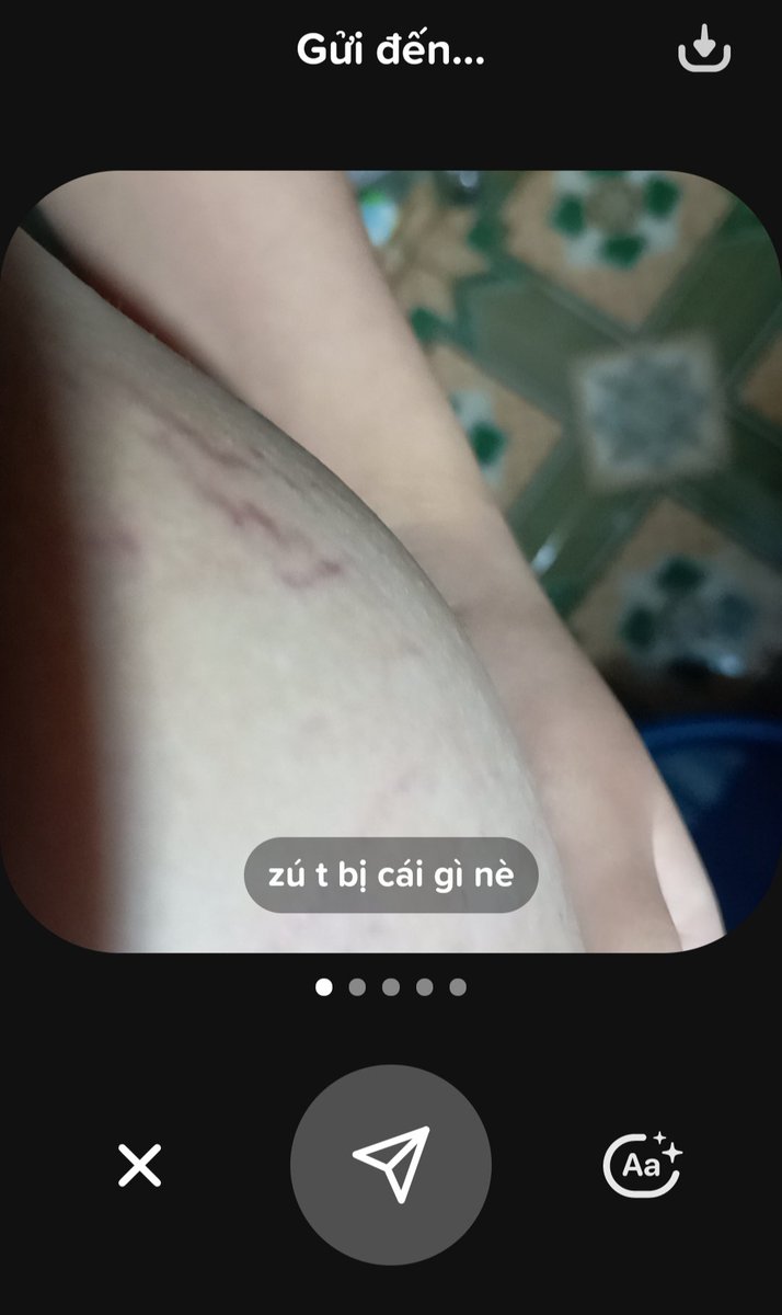 rạn như này còn cứu nổi không vậy trời😭