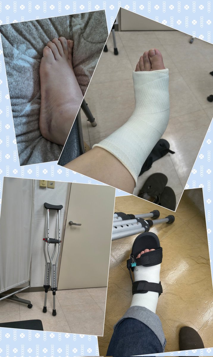 spearmint8296's tweet photo. 骨折してちょうど１カ月、ギブスがとれました
でも、まだ七割程度しか骨はくっついてないって…
角度によるのかもしれないけど、足首がなんか細い
左足をかばっていたからか、ここのところ右足にダメージがきていて階段とかかなりきついんだけど、明日から大丈夫なのだろうか https://t.co/bJs2RiyWl3