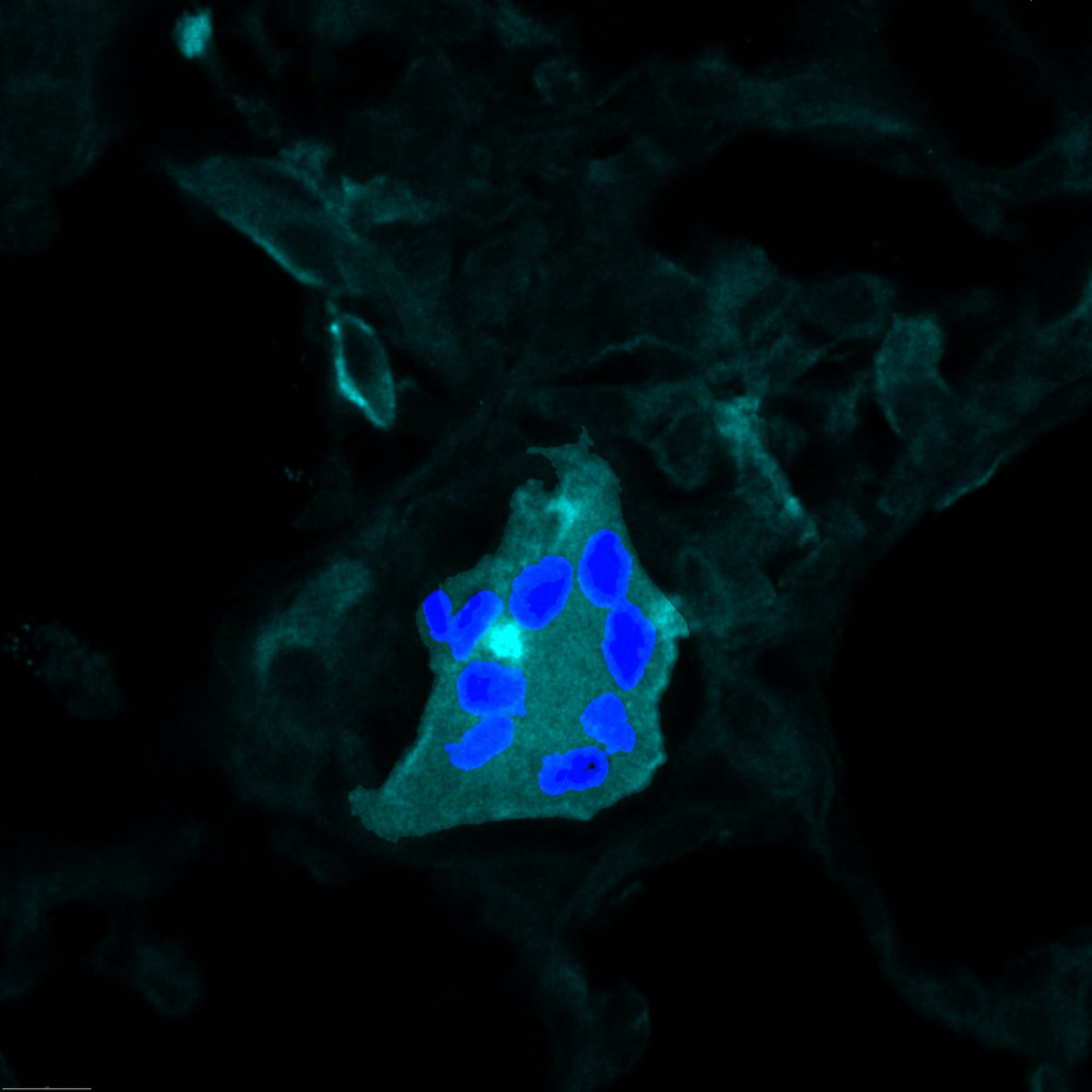 ERC_Research's tweet image. New study led by Bart Lambrecht at VIB shows that key lung immune cells can switch from protectors to drivers of inflammation during allergic reactions like asthma.

These findings challenge long-held views and point to new treatment strategies.

👉 link.europa.eu/W6FqCh