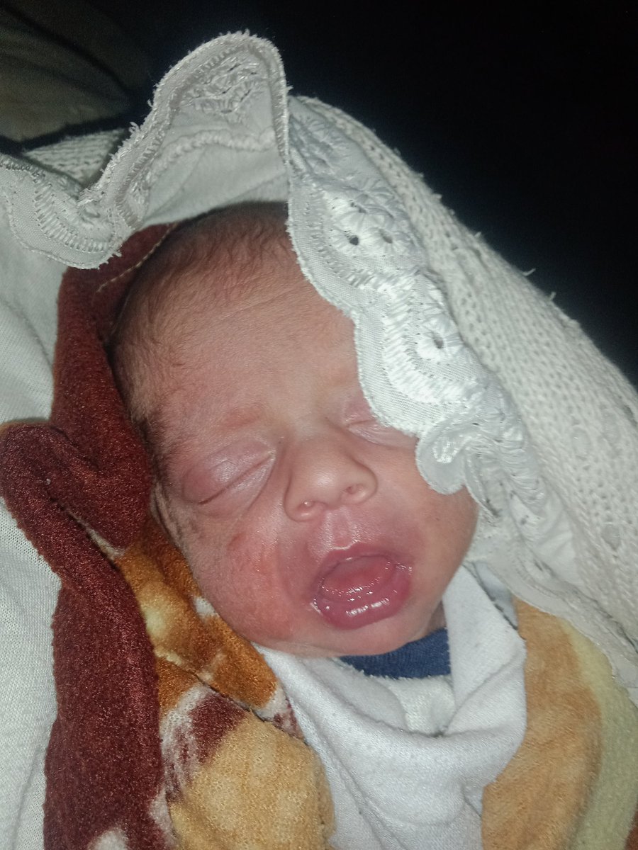 🚨Yesterday I didn't recognize my daughter's face. She turned blue due to lack of oxygen. I almost lost her 😭

My daughter is still suffering.
Her treatment is still on hold.
And winter is still here.
Donations are arriving at a slower pace than her illness is worsening 💔

I