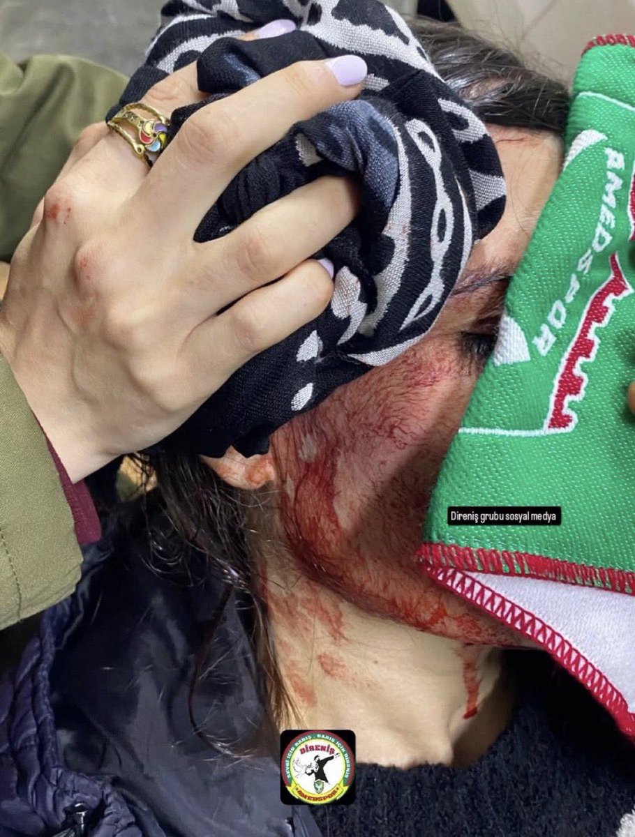 Bodrum’da aralarında kadın ve çocukların da bulunduğu Amedspor taraftarlarına alçakça bir saldırı yapılmış.
Sizin yaptığınız korkaklıktır, kancıklıktır. Bu saldırının tek sorumlusu Bursaspor’un başkanı Enes Çelik, sesiz kalan TFF yetkilileri ve tribünde küfür eden o soysuz