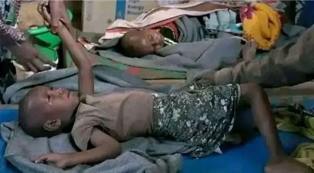 Tigray_3's tweet photo. Bleeding inside 💔
#TegaruIDPs at Hinsati Camp are dying due to a lack of food and medical supplies.
Tigray urgently needs help.
#ReturnTegaruIDPs
#EndTigraySiege
@hrw
@WFP
@WHO
@DrTedros @UNHumanRights @Refugees @UNICEF @UNOCHA 
@Tigray_3 https://t.co/gqdaCexf4F