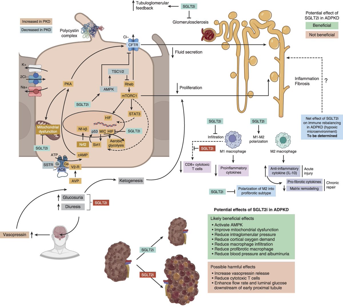 asnpublications's tweet photo. SGLT2is, by virtue of their kidney, metabolic, hemodynamic, and cardioprotective effects, represent a promising therapeutic strategy for ADPKD. Read the full review in #ASNJASN: https://t.co/qFdrCaPHor https://t.co/iSVdwqJBSt