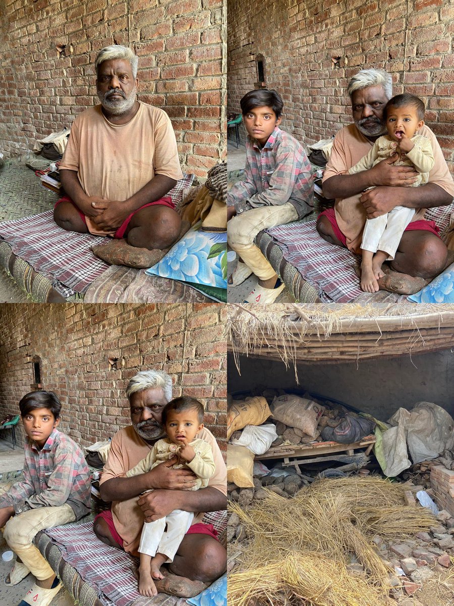 Missis_FawadK23's tweet photo. A Life-Changing Appeal 🙏
This man lost both legs in a tragic road accident a few years ago.
Today, he is struggling to survive with his children under extreme financial hardship.
He is not asking for charity — he is asking for a chance to earn with dignity.
He needs one 👇1/2 https://t.co/yI8mzH2PNc