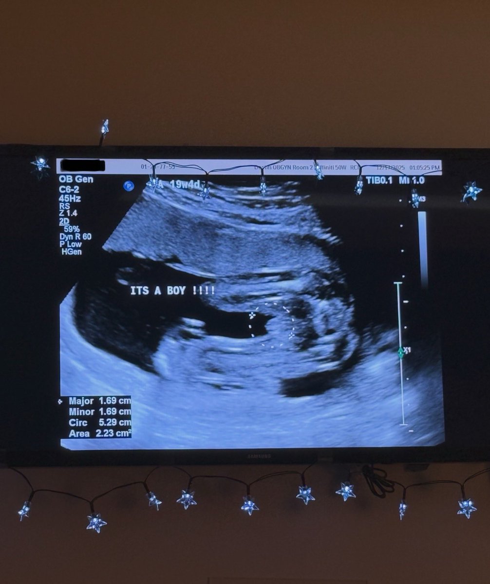 suicideLEOPARD's tweet image. THANKS FOR A GREAT YEAR YALL I HOPE YALL HAVE A BLESSED HOLIDAY SEASON AND ILL SEE YOU GUYS NEXT SUMMER OR SOMETHING IDK WE'LL SEE