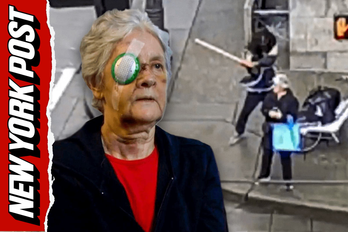 nypost's tweet image. Elderly Seattle woman has eye gouged out in random daylight attack by repeat thug trib.al/O1D0Hj1