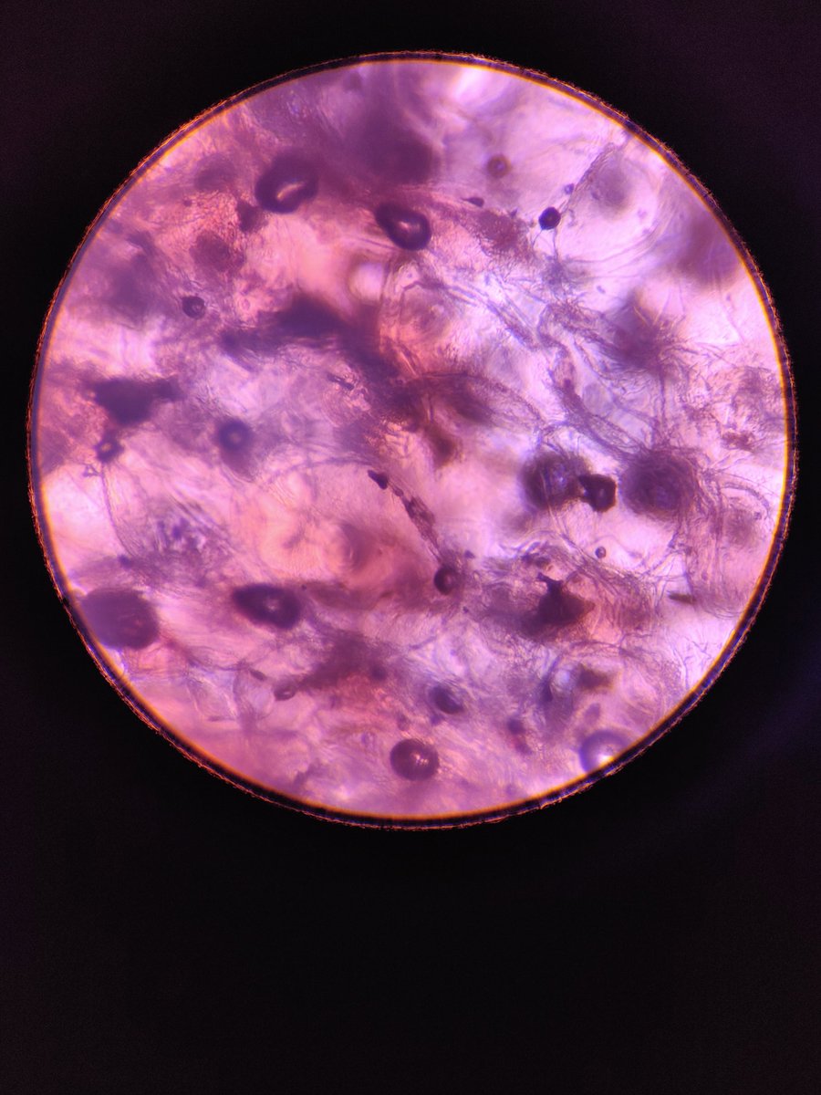 ObjectFromEons's tweet image. Thin slice of strawberry under microscope x4 because closer makes it blurry no matter how I adjust