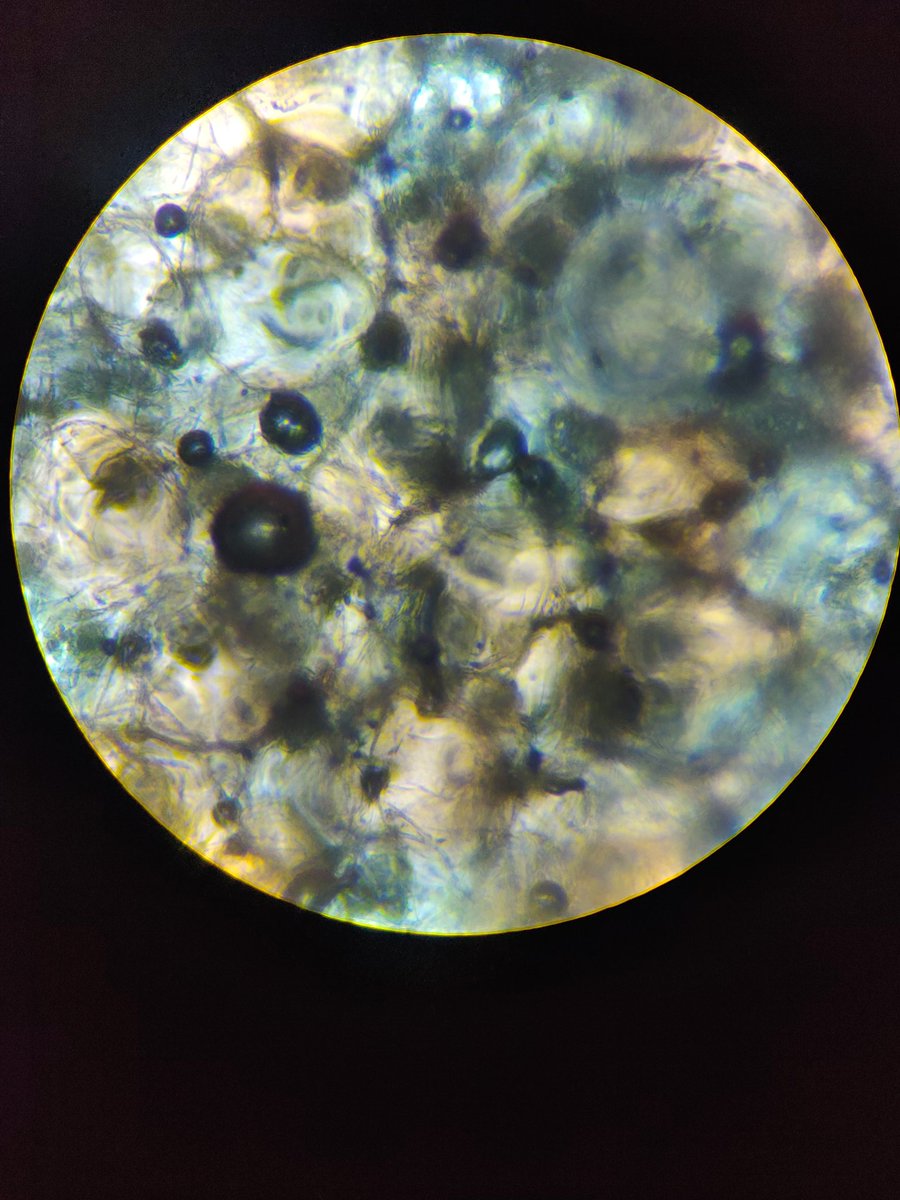 ObjectFromEons's tweet image. Thin slice of strawberry under microscope x4 because closer makes it blurry no matter how I adjust