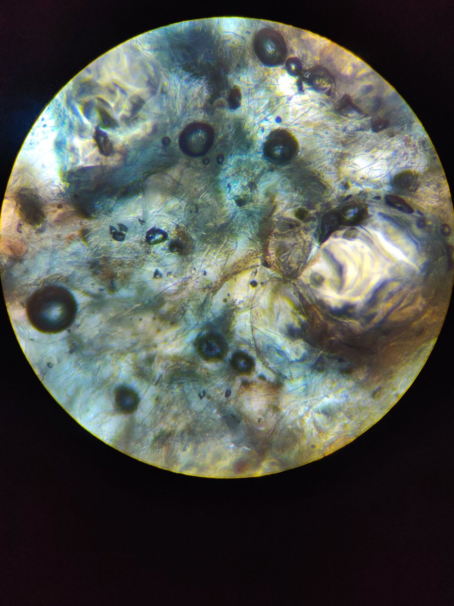 ObjectFromEons's tweet image. Thin slice of strawberry under microscope x4 because closer makes it blurry no matter how I adjust