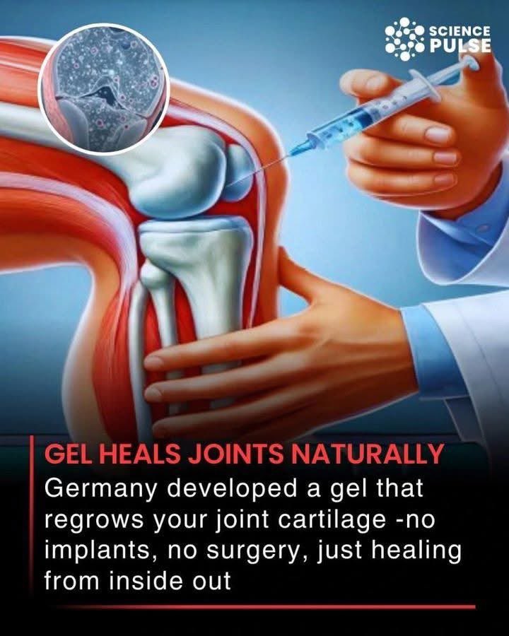 Германчууд өвдөгний үеийг сэргээх тарилга бүтээжээ.
Ялангуяа монголчууд бидэнд хамгийн өргөн тулгардаг асуудал бол үе мөчний өвчин!
Аавын маань өвдөгөөр хатгуулаад хэцүү байдаг байж билээ, хөөрхий.
Гайхалтай сайхан мэдээг настан буурлууддаа дуулгахсан.
2026 онд худалдаанд гарах