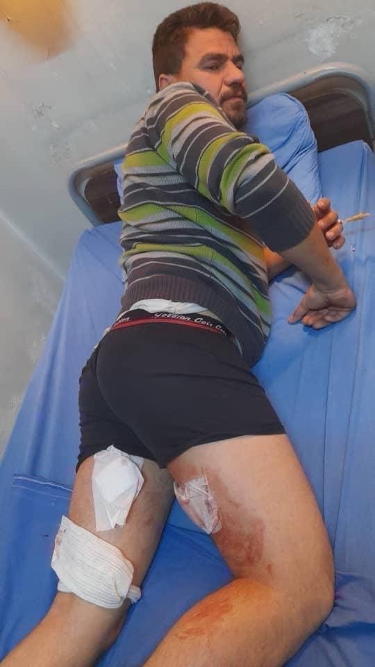 HisoEla's tweet photo. عاجل
ارتفعت حصيلة القصف المدفعي والصاروخي الذي تنفذه فصائل حكومة دمشق على أحياء الشيخ مقصود والأشرفية إلى شهيد مدني و17 جريحاً، وسط استهداف مباشر للمنازل والمناطق المأهولة بالسكان https://t.co/tO84WuFmRO