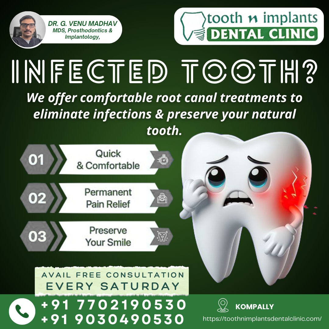 ToothnImplants's tweet image. #RootCanalTreatment #InfectedTooth #KompallyDentist #ToothNImplants #DrVenuMadhav #PainlessDentistry #SaveYourTooth #RootCanalSpecialist #HyderabadDentist #SecunderabadDental #OralHealth #ToothAcheRelief #DentalCare #ExpertDentist #SmileRestoration #HealthySmile #FreeConsultation